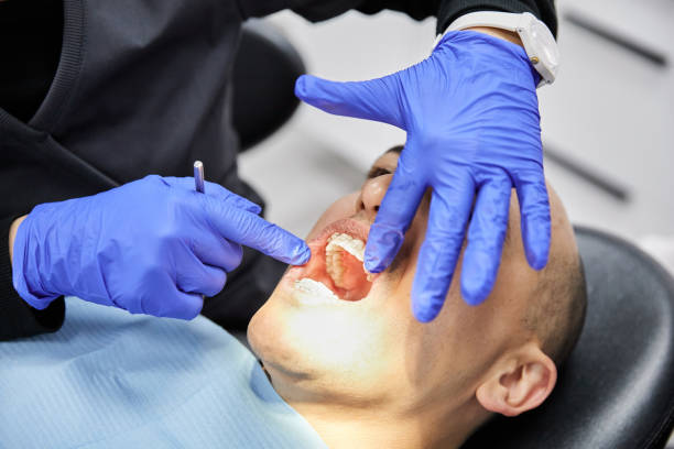 Best Broken or Cracked Tooth Emergency Dentist in Clinton, SC
