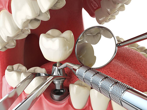 Best Emergency Dental Services for Seniors in Clinton, SC